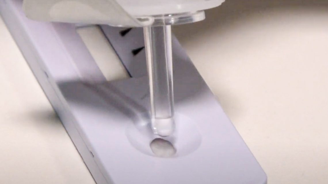 Corona Antigen Schnelltest